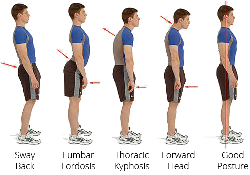 What is a good posture ?